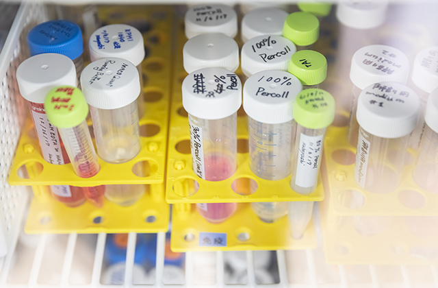 ES細胞やiPS細胞を使った再生医療